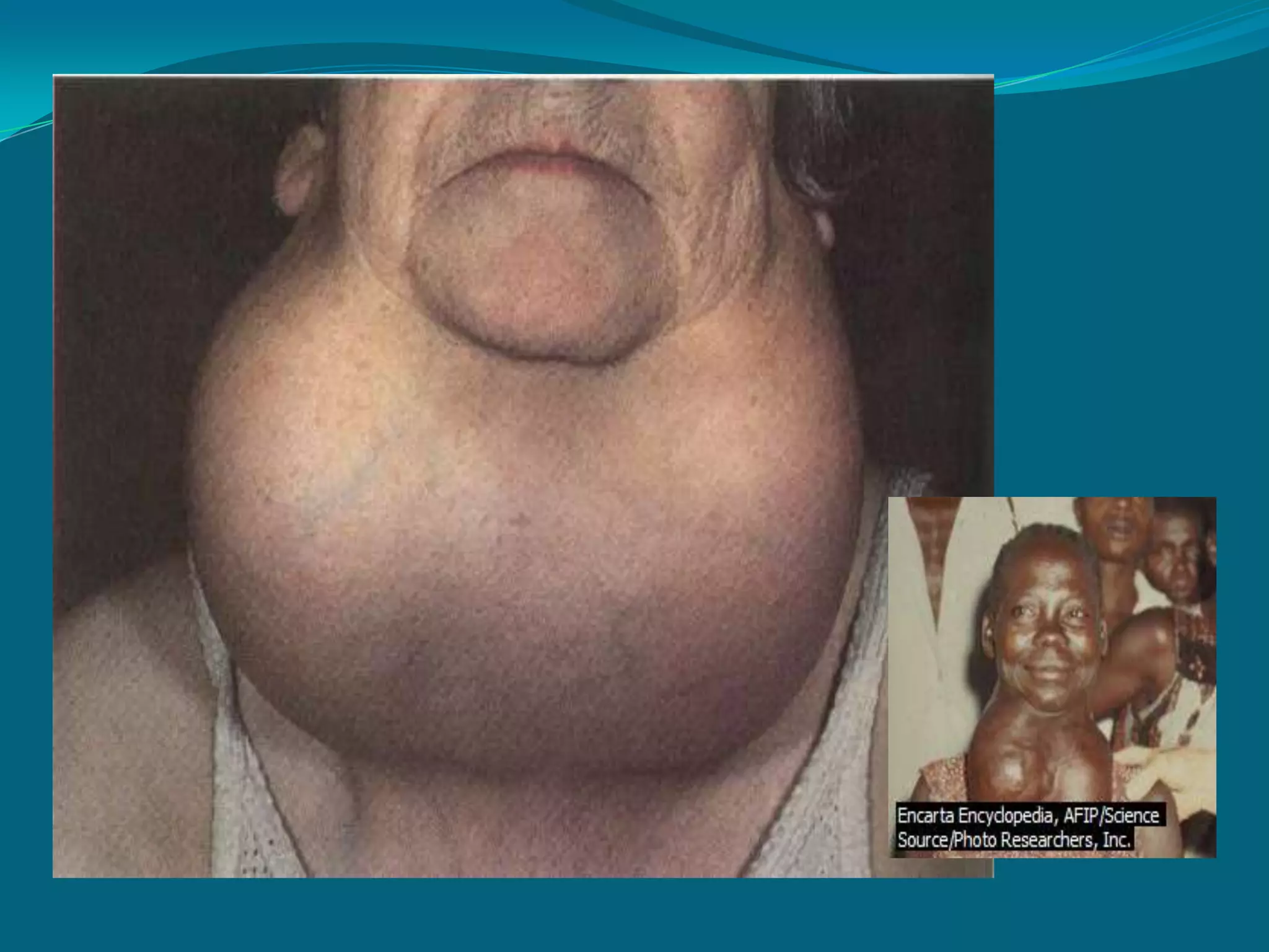    fluid and fiber to relieve constipation