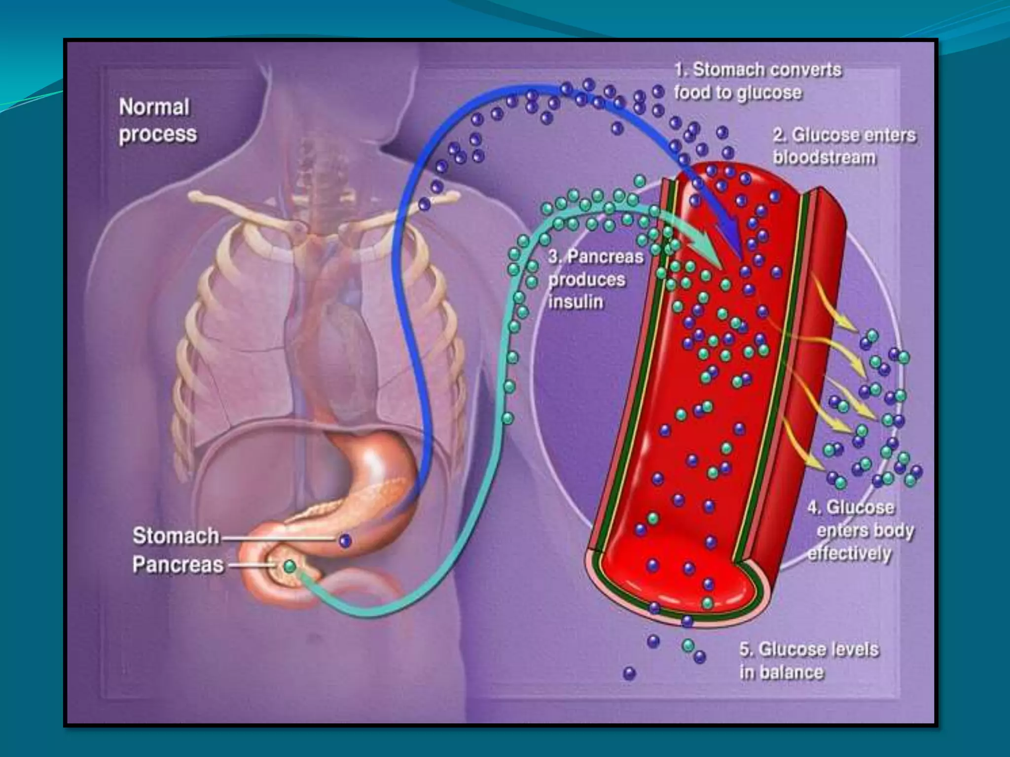  total thyroidectomy (if carcinoma is present)Nsg. Interventions:Provide calm, restful envt. physical comfort, cool envt. temp., bathe frequently w/ cool waterprovide adequate rest, avoid muscle fatigue stressors in the envt.— noise and lightsrelaxation techniquesProvide adequate nutrients calorie,  protein, balanced diet (4,000-5,000 cal/day) fluid intakeRestrict stimulants (tea, coffee, alcohol)small, frequent feedings if hypermotility is presentDaily wt.