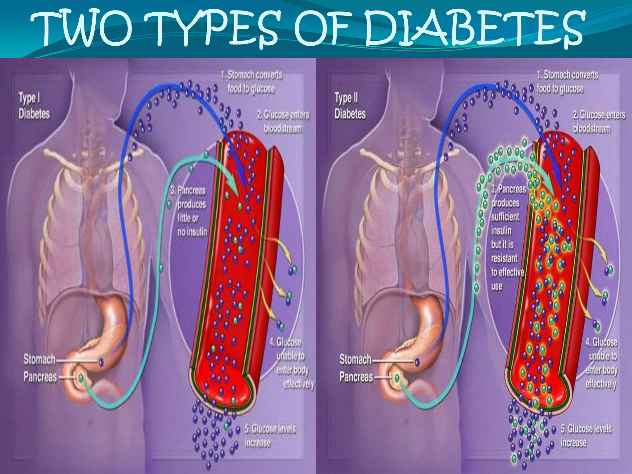 Nsg. Interventions:Provide emotional supportProvide eye careeye drops, dark glasses, patch eyes if necessaryelevate head of bed for sleeprestrict dietary sodiumassess adequacy of lid closureBe alert for complications