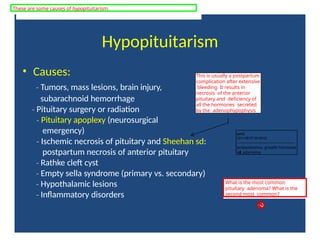 Hypopituitarism
• Causes:
‐ Tumors, mass lesions, brain injury,
subarachnoid hemorrhage
‐ Pituitary surgery or radiation
‐ Pituitary apoplexy (neurosurgical
emergency)
‐ Ischemic necrosis of pituitary and Sheehan sd:
postpartum necrosis of anterior pituitary
‐ Rathke cleft cyst
‐ Empty sella syndrome (primary vs. secondary)
‐ Hypothalamic lesions
‐ Inflammatory disorders
This is usually a postpartum
complication after extensive
bleeding. It results in
necrosis of the anterior
pituitary and deficiency of
all the hormones secreted
by the adenophypophysis
What is the most common
pituitary adenoma? What is the
second most common?
These are some causes of hypopituitarism.
tcl12
2011-06-07 03:00:02
--------------------------------------------
prolactinoma; growth hormone
cell adenoma
 