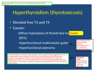Hyperthyroidism (thyrotoxicosis)
• Elevated free T3 and T4
• Causes:
‐ Diffuse hyperplasia of thyroid due to Graves
(85%)
‐ Hyperfunctional multinodular goiter
‐ Hyperfunctional adenoma
Multinodular goiter
doesn't always
produce
hyperthyroidism. It
can produce a
euthyroid state or
hypothyroidism.
Grave's disease is an autoimmune disease in which autoantibodies against the thyroid
stimulating hormone receptor (TSHR) of the thyroid follicular cells ACTIVATE the
receptor. This causes an increase in the production and secretion of T3 and T4
independent of TSH. In fact, the high levels T3 and T4 would downregulate TRH and
TSH secretion. Thus, Grave's disease is noted for paradoxically high T3 and T4 with low
TRH and TSH.
Long story
short...
Grave's Disease:
T3 and T4: high
TRH: Low
TSH: Low
Hyperthyroidism: Too much T3, the metabolically active thyroid
hormone.
 