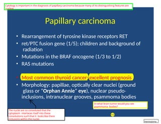 Papillary carcinoma
• Rearrangement of tyrosine kinase receptors RET
• ret/PTC fusion gene (1/5); children and background of
radiation
• Mutations in the BRAF oncogene (1/3 to 1/2)
• RAS mutations
• Most common thyroid cancer; excellent prognosis
• Morphology: papillae, optically clear nuclei (ground
glass or “Orphan Annie” eye), nuclear pseudo‐
inclusions, intranuclear grooves, psammoma bodies
The nuclei are so convoluted that the
cytoplasm interlaces itself into these
convolutions such that it looks like there
inclusions within the nuclei.
In what brain tumor would you see
psammoma bodies?
Cytology is important in the diagnosis of papillary carcinoma because many of its distinguishing features are
nuclear.
meningioma
 