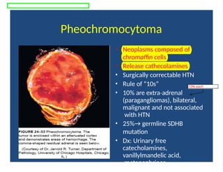 Pheochromocytoma
• Neoplasms composed of
chromaffin cells
• Release cathecolamines
• Surgically correctable HTN
• Rule of “10s”
• 10% are extra adrenal
‐
(paragangliomas), bilateral,
malignant and not associated
with HTN
• 25%→ germline SDHB
mutation
• Dx: Urinary free
catecholamines,
vanillylmandelic acid,
metanephrines
10% each
 