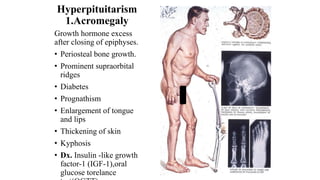 ENDOCRINE PATHOLOGY NOTES- DIPLOMA.pptx