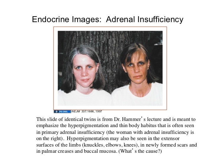 Images of Endocrine Disorders