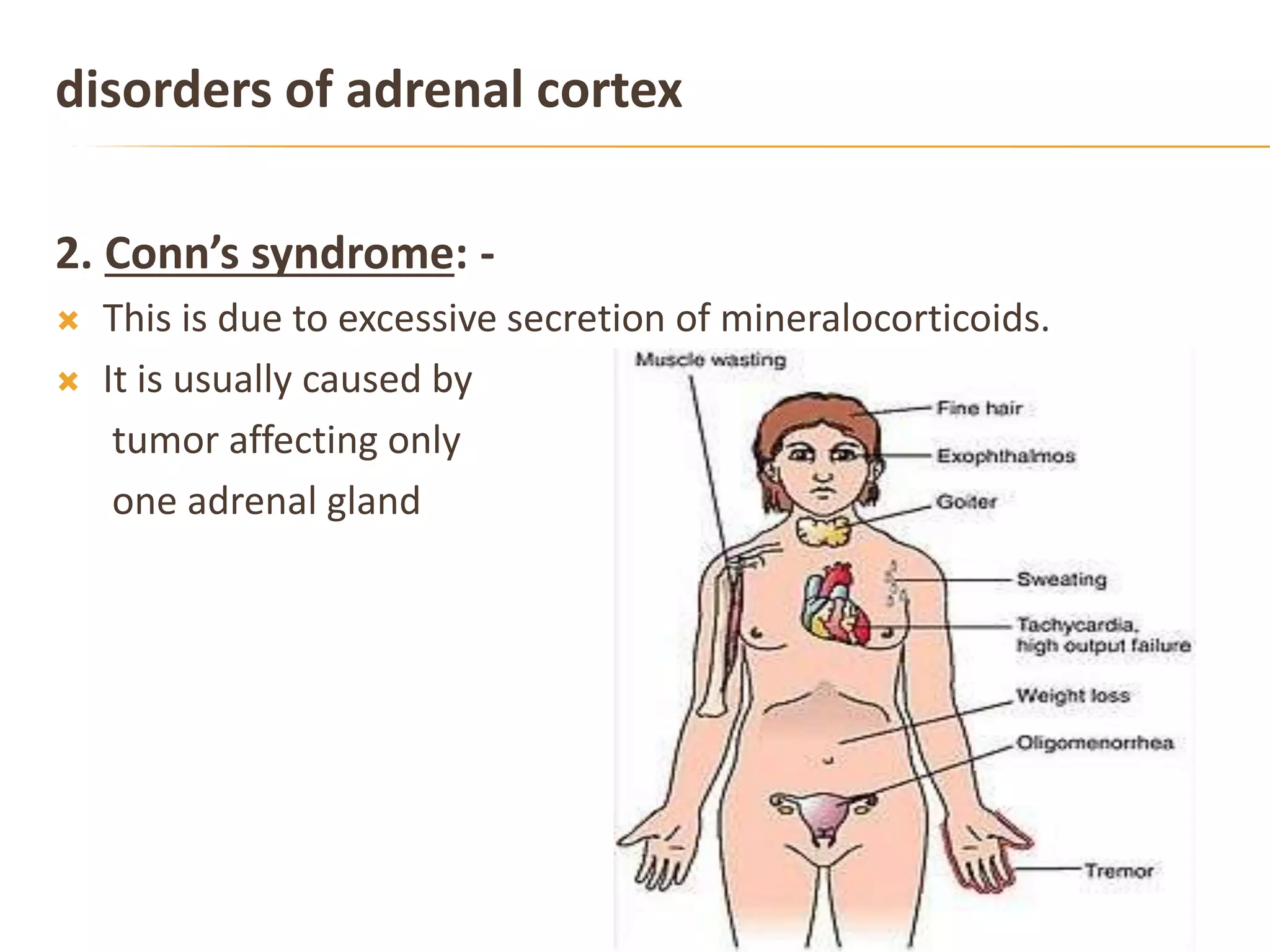 disorders of adrenal cortex
2. Conn’s syndrome: -
 This is due to excessive secretion of mineralocorticoids.
 It is usually caused by
tumor affecting only
one adrenal gland
 