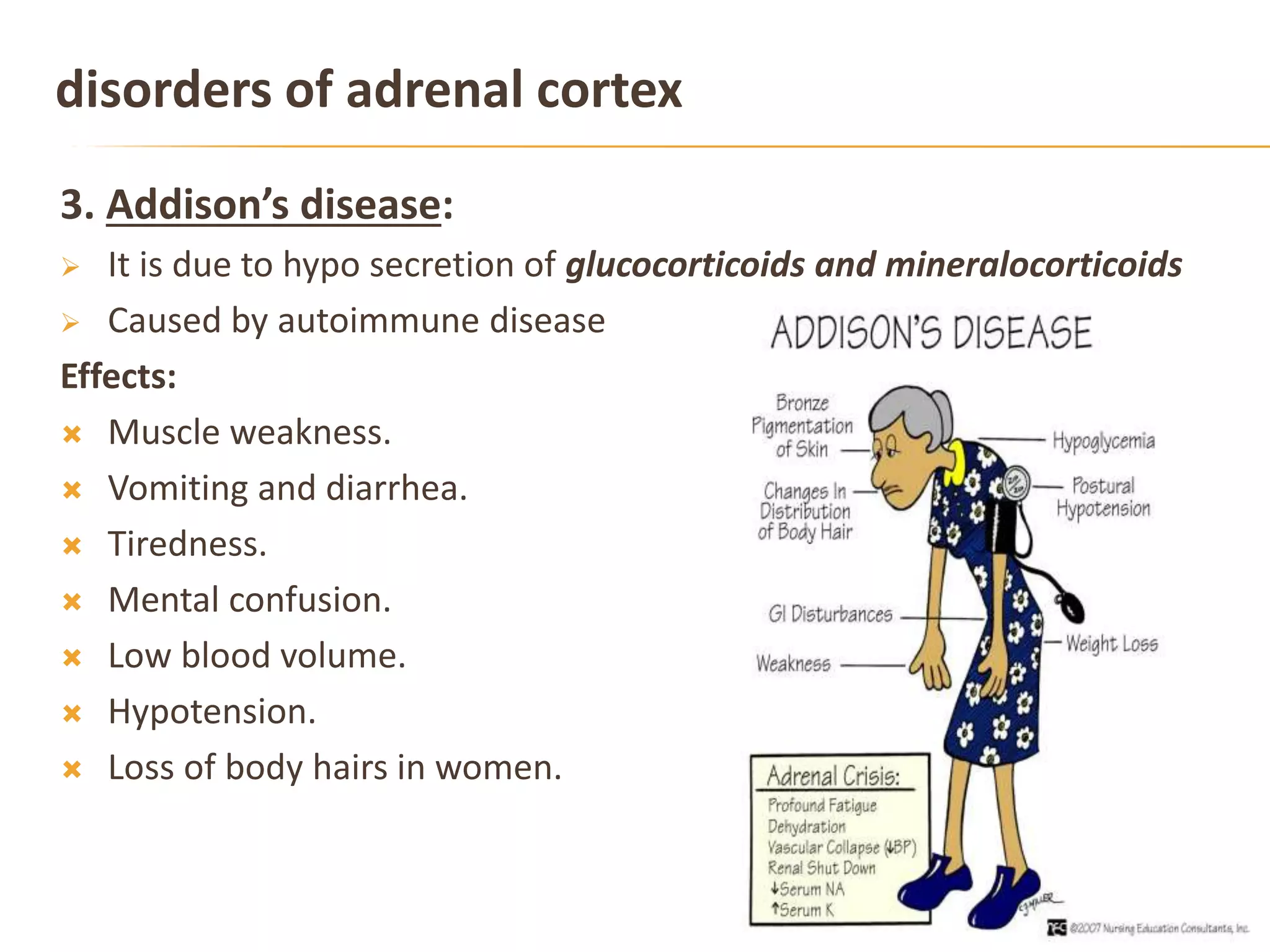 disorders of adrenal cortex
3. Addison’s disease:
 It is due to hypo secretion of glucocorticoids and mineralocorticoids
 Caused by autoimmune disease
Effects:
 Muscle weakness.
 Vomiting and diarrhea.
 Tiredness.
 Mental confusion.
 Low blood volume.
 Hypotension.
 Loss of body hairs in women.
 