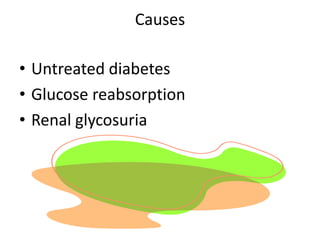 CausesUntreated diabetesGlucose reabsorptionRenal glycosuria