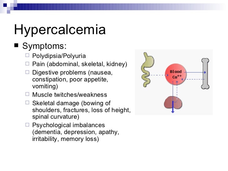 hypercalcemia causes usmle mynotes