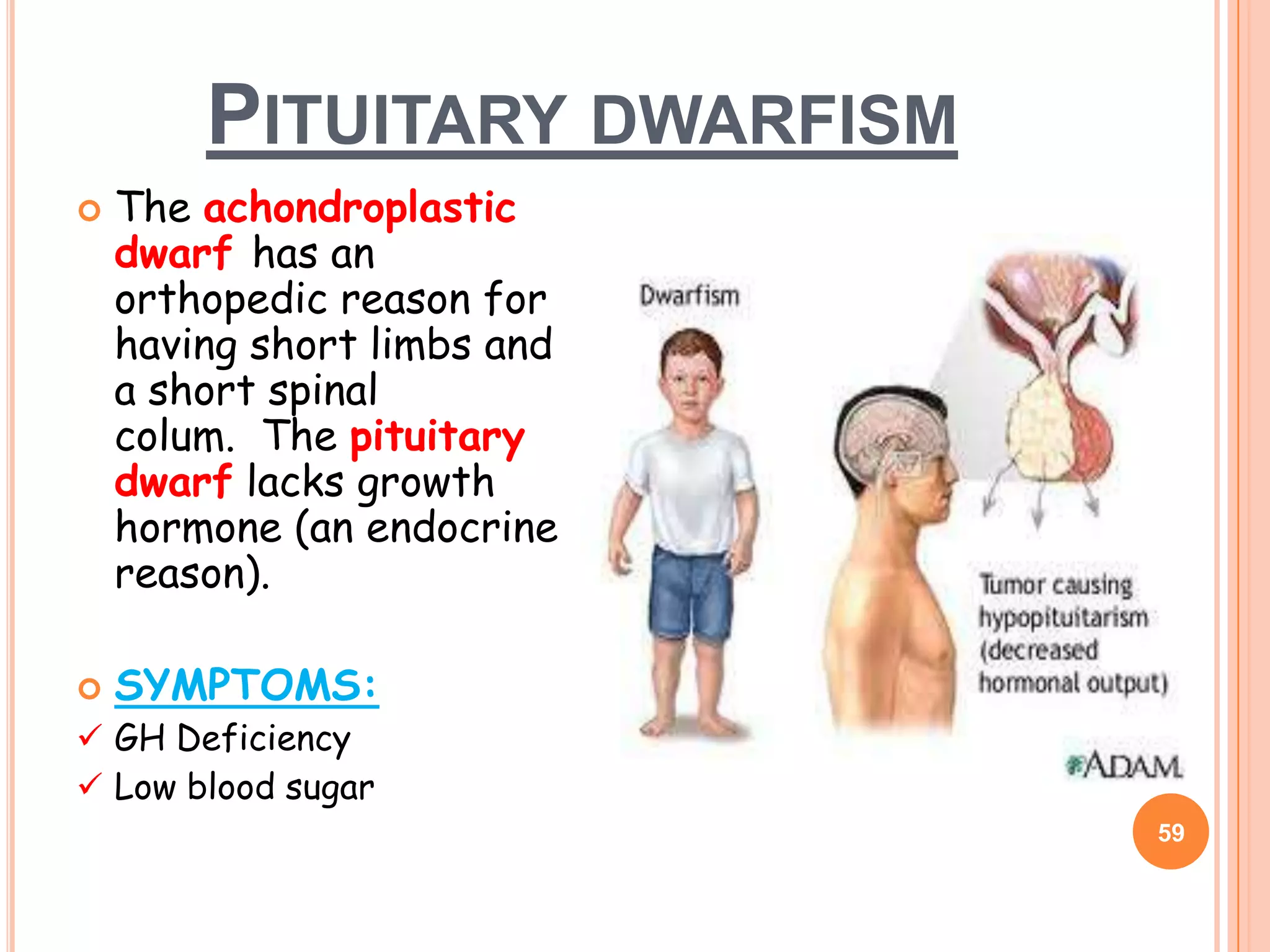 PITUITARY DWARFISM
   The achondroplastic
    dwarf has an
    orthopedic reason for
    having short limbs and
    a short spinal
    colum. The pituitary
    dwarf lacks growth
    hormone (an endocrine
    reason).

   SYMPTOMS:
 GH Deficiency
 Low blood sugar
                             59
 