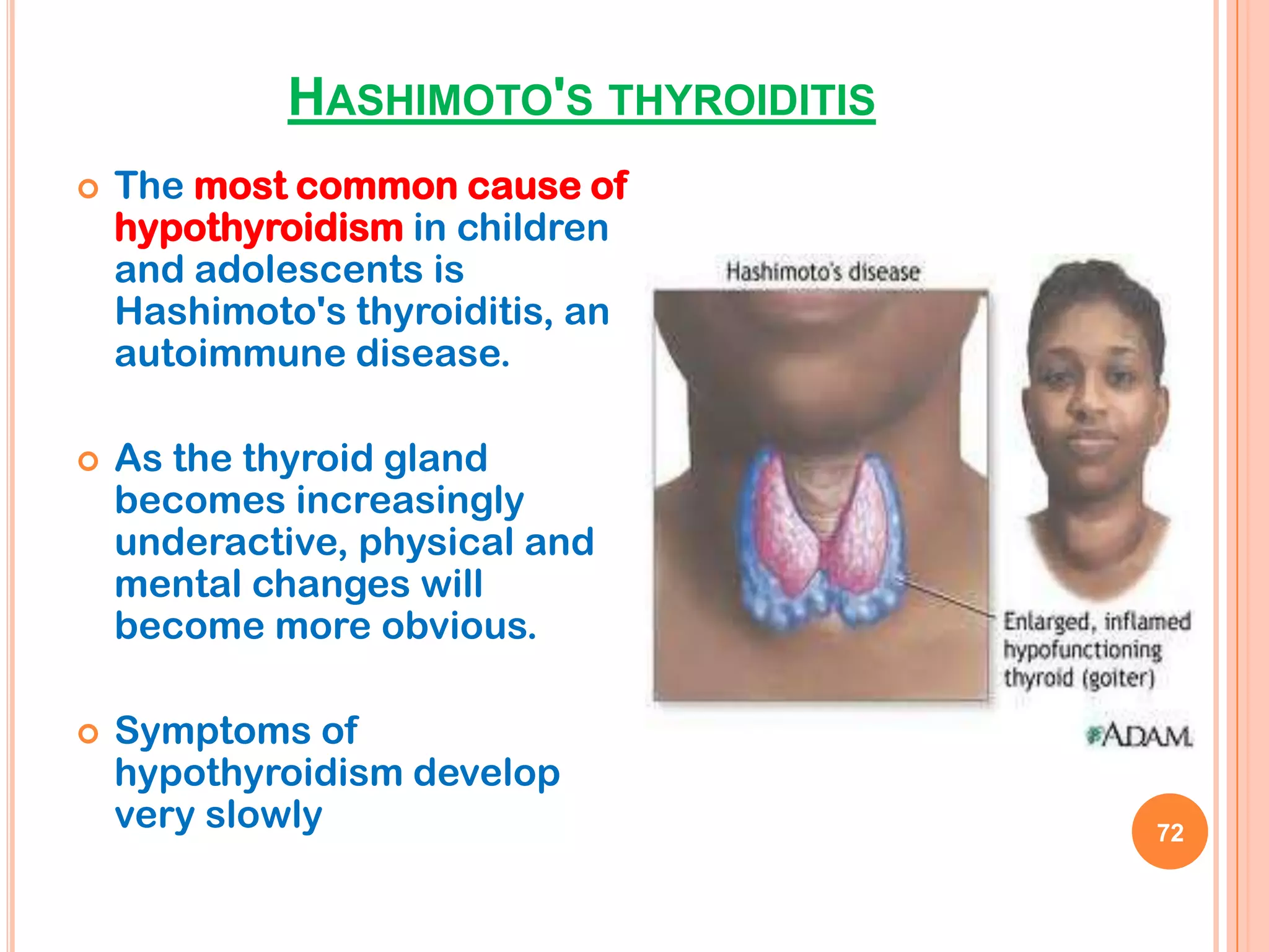 HASHIMOTO'S THYROIDITIS
   The most common cause of
    hypothyroidism in children
    and adolescents is
    Hashimoto's thyroiditis, an
    autoimmune disease.

   As the thyroid gland
    becomes increasingly
    underactive, physical and
    mental changes will
    become more obvious.

   Symptoms of
    hypothyroidism develop
    very slowly                        72
 