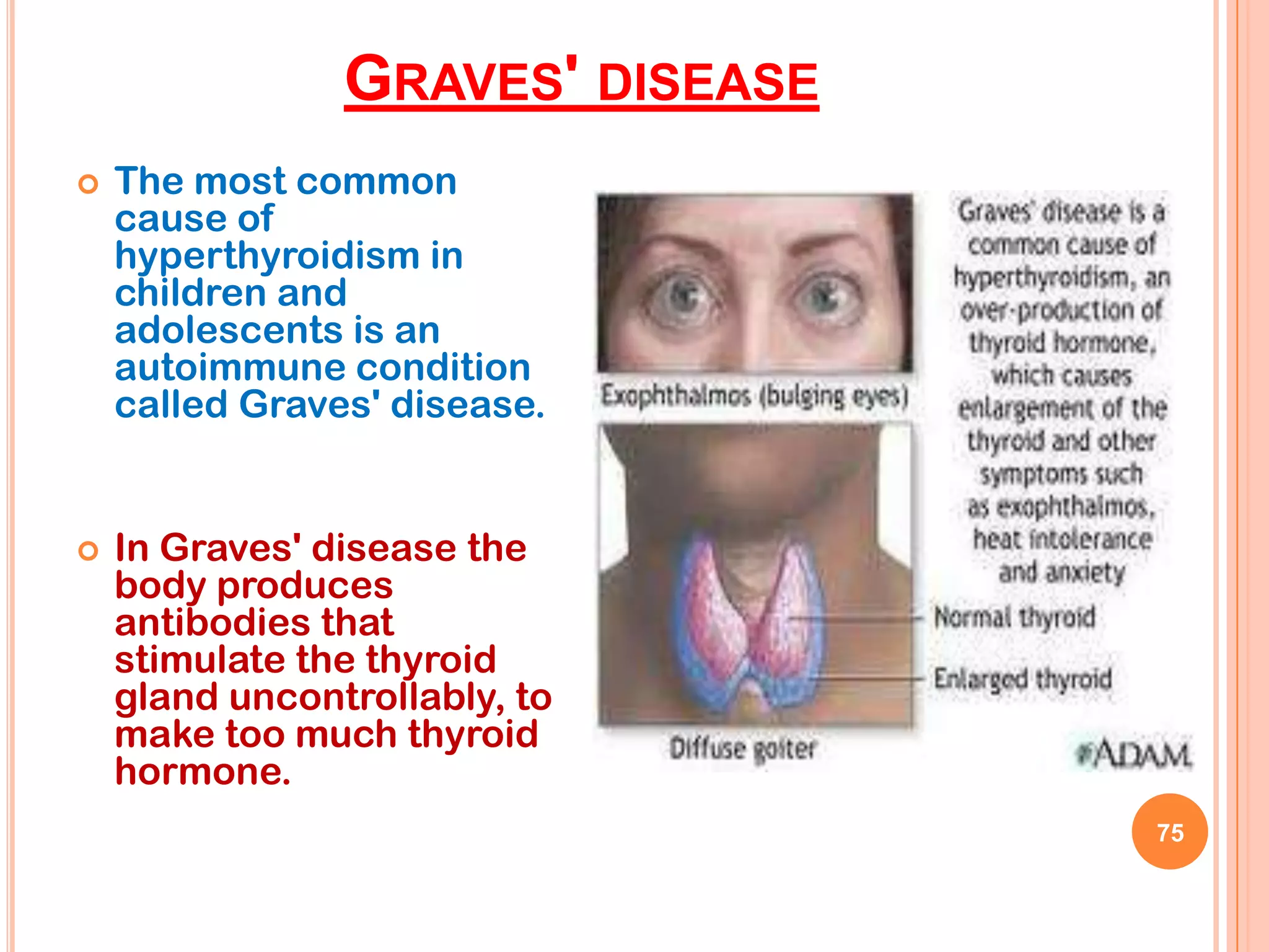 GRAVES' DISEASE
   The most common
    cause of
    hyperthyroidism in
    children and
    adolescents is an
    autoimmune condition
    called Graves' disease.


   In Graves' disease the
    body produces
    antibodies that
    stimulate the thyroid
    gland uncontrollably, to
    make too much thyroid
    hormone.
                                  75
 