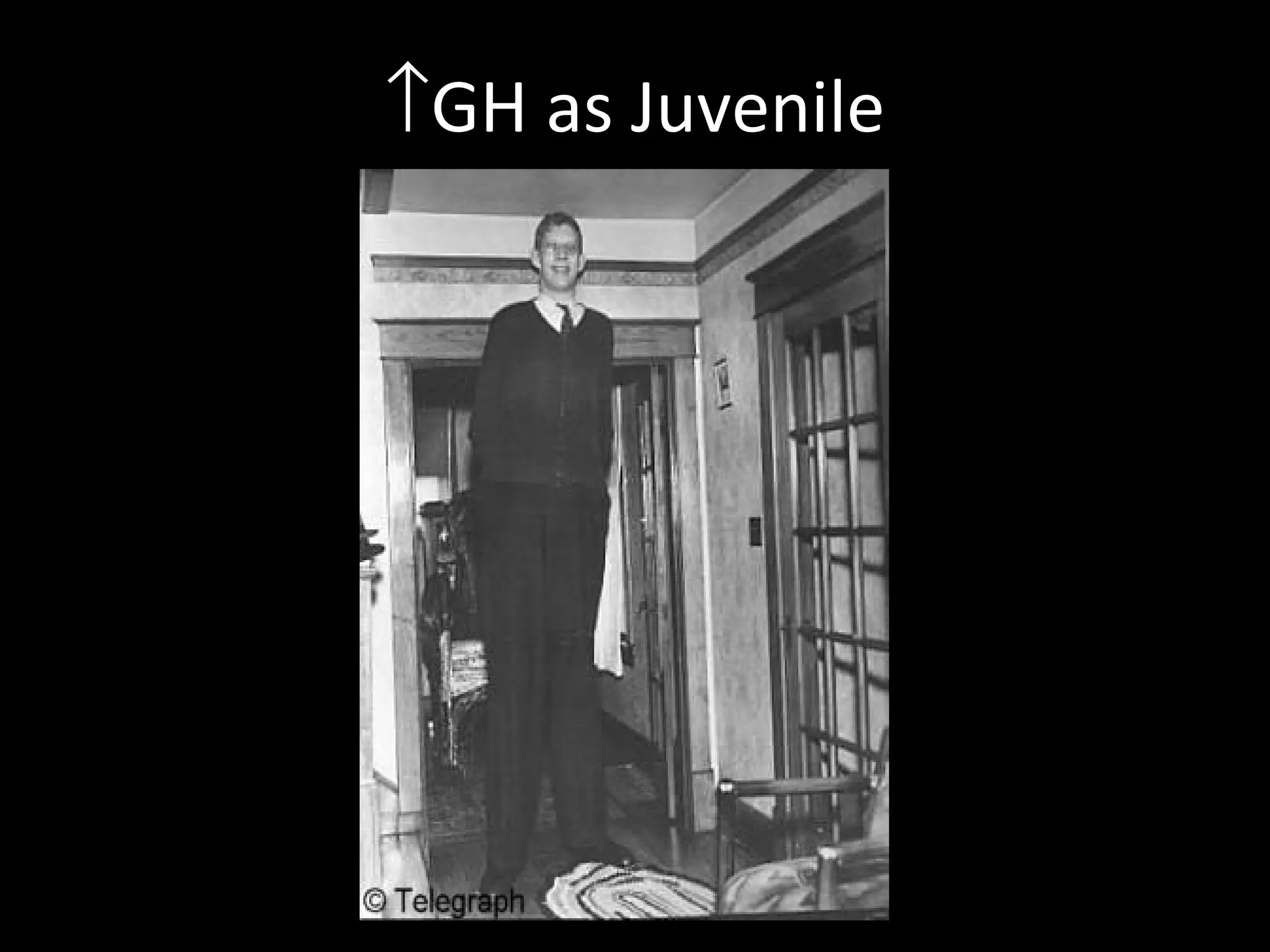 ↑GH as Juvenile
 