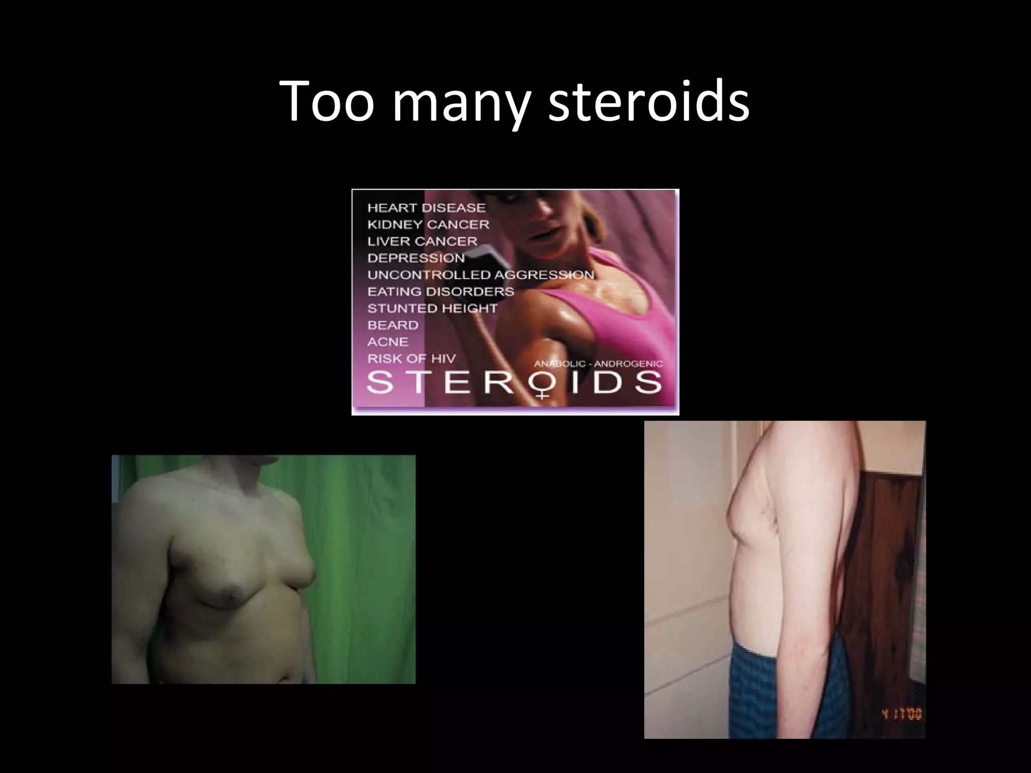 Too many steroids
 