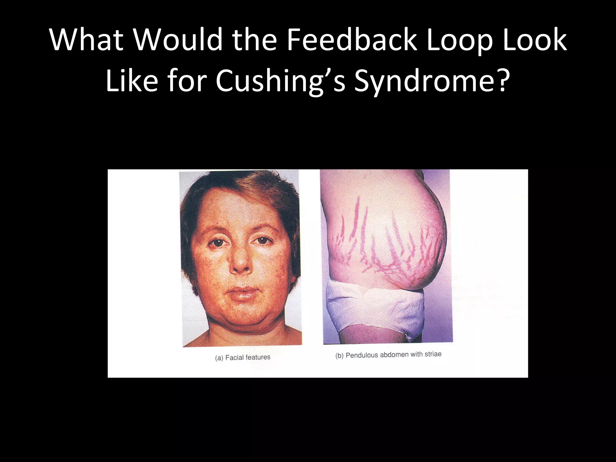What Would the Feedback Loop Look
   Like for Cushing’s Syndrome?
 