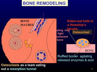 71
Osteoclast
Ruffled border agitating
released enzymes & acid
Eaten-out hole is
a Howship’s
lacuna
BONE REMODELING
Osteoclasts as a team eating
out a resorption tunnel
Sealing ring
of tight
attachment
to bone
BONE
MATRIX
BONE
 