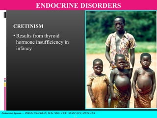 Endocrine System…. POOJA SAHARAN, M.Sc NSG. I YR. M.M C.O.N, MULLANA
2 1
ENDOCRINE DISORDERS
CRETINISM
• Results from thyroid
hormone insufficiency in
infancy
 