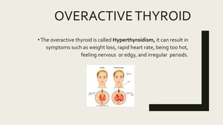 OVERACTIVETHYROID
•The overactive thyroid is called Hyperthyroidism, it can result in
symptoms such as weight loss, rapid heart rate, being too hot,
feeling nervous or edgy, and irregular periods.
 