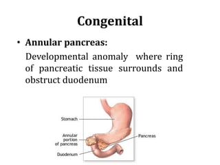 Congenital
• Annular pancreas:
Developmental anomaly where ring
of pancreatic tissue surrounds and
obstruct duodenum
 