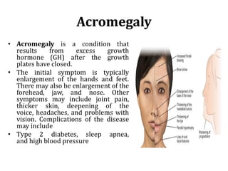 Acromegaly
• Acromegaly is a condition that
results from excess growth
hormone (GH) after the growth
plates have closed.
• The initial symptom is typically
enlargement of the hands and feet.
There may also be enlargement of the
forehead, jaw, and nose. Other
symptoms may include joint pain,
thicker skin, deepening of the
voice, headaches, and problems with
vision. Complications of the disease
may include
• Type 2 diabetes, sleep apnea,
and high blood pressure
 