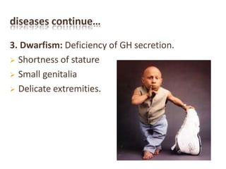 diseases continue…
3. Dwarfism: Deficiency of GH secretion.
 Shortness of stature
 Small genitalia
 Delicate extremities.
 
