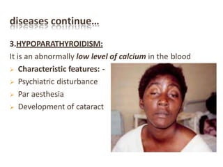 diseases continue…
3.HYPOPARATHYROIDISM:
It is an abnormally low level of calcium in the blood
 Characteristic features: -
 Psychiatric disturbance
 Par aesthesia
 Development of cataract
 