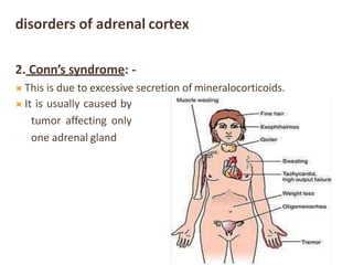 disorders of adrenal cortex
2. Conn’s syndrome: -
 This is due to excessive secretion of mineralocorticoids.
 It is usually caused by
tumor affecting only
one adrenal gland
 