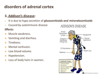 disorders of adrenal cortex
3. Addison’s disease:
 It is due to hypo secretion of glucocorticoids and mineralocorticoids
 Caused by autoimmune disease
Effects:
 Muscle weakness.
 Vomiting and diarrhea.
 Tiredness.
 Mental confusion.
 Low blood volume.
 Hypotension.
 Loss of body hairs in women.
 