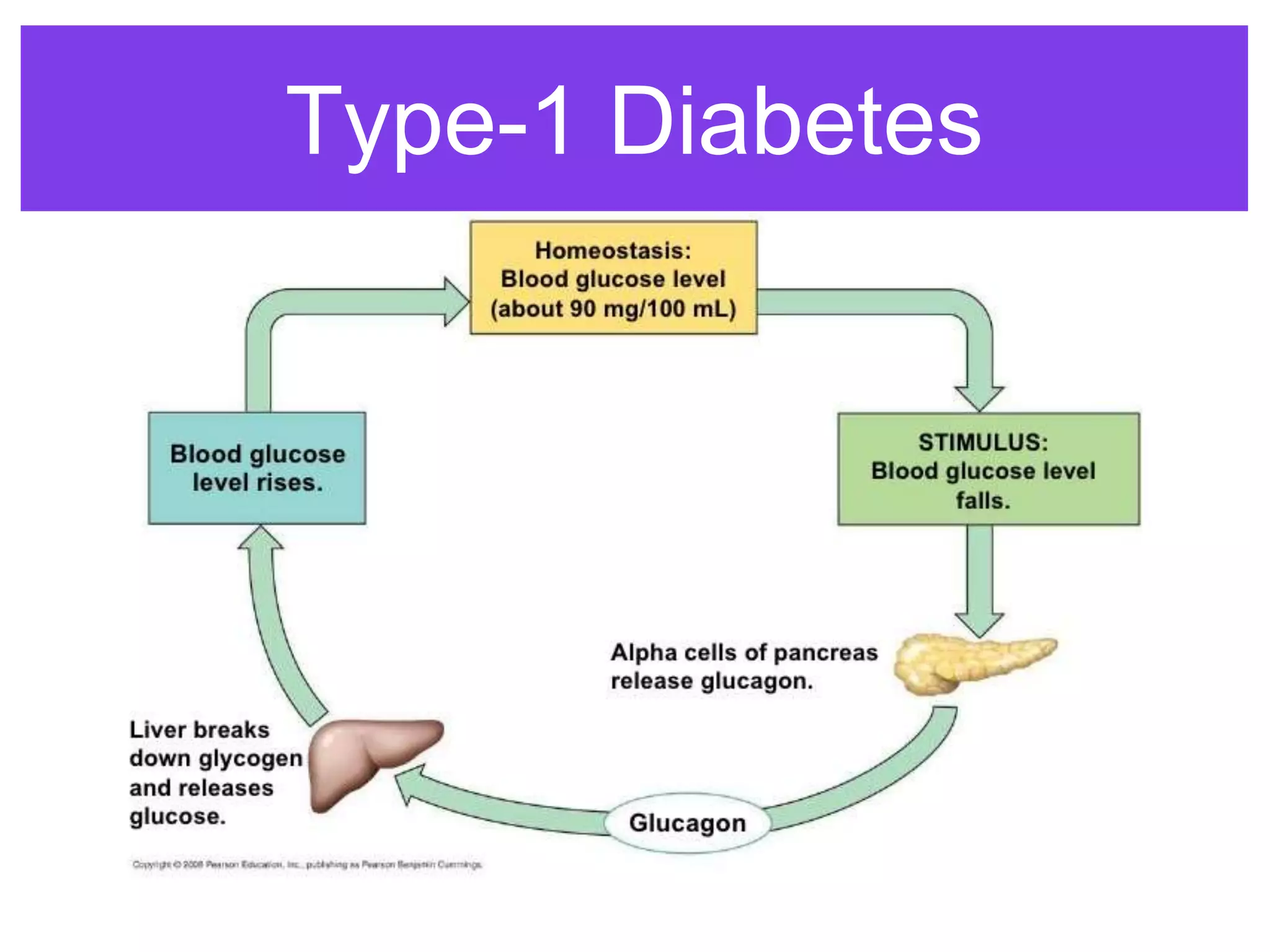 Type-1 Diabetes
 