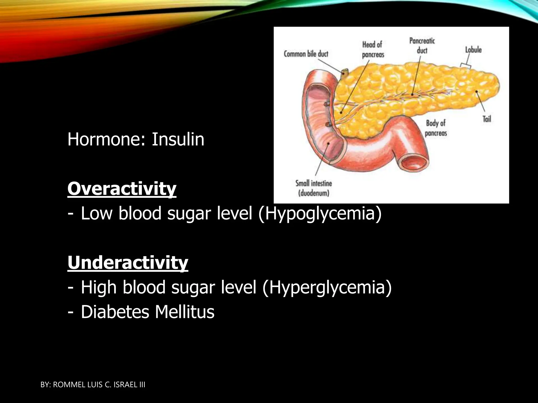 PANCREAS
Hormone: Insulin
Overactivity
- Low blood sugar level (Hypoglycemia)
Underactivity
- High blood sugar level (Hyperglycemia)
- Diabetes Mellitus
BY: ROMMEL LUIS C. ISRAEL III
11
 