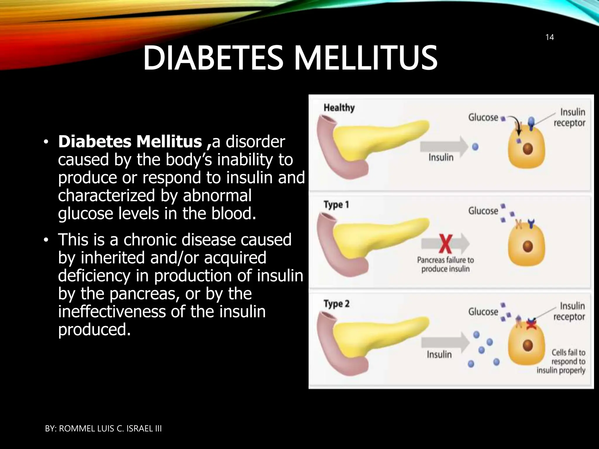 DIABETES MELLITUS
• Diabetes Mellitus ,a disorder
caused by the body’s inability to
produce or respond to insulin and
characterized by abnormal
glucose levels in the blood.
• This is a chronic disease caused
by inherited and/or acquired
deficiency in production of insulin
by the pancreas, or by the
ineffectiveness of the insulin
produced.
BY: ROMMEL LUIS C. ISRAEL III
14
 