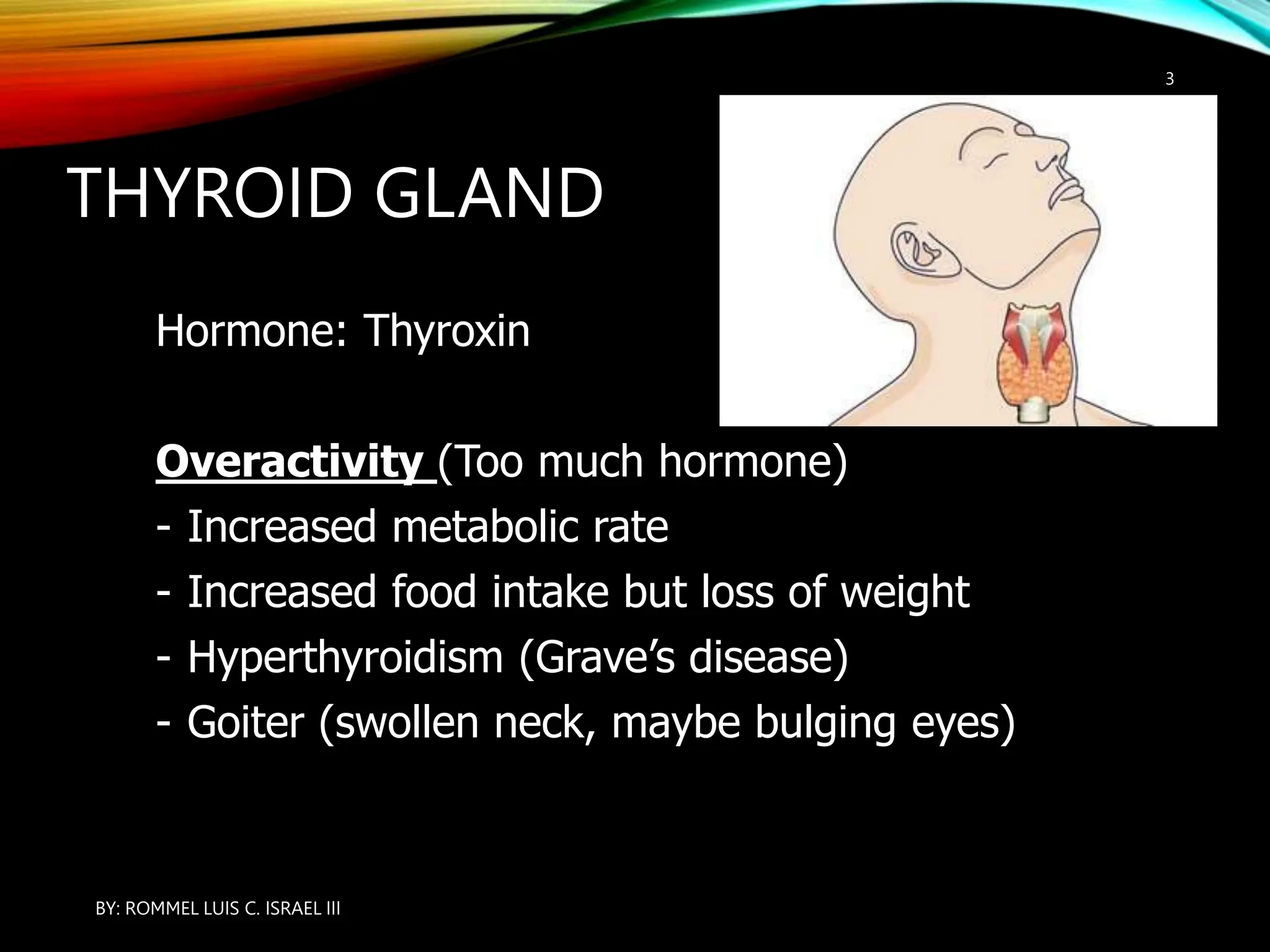 THYROID GLAND
Hormone: Thyroxin
Overactivity (Too much hormone)
- Increased metabolic rate
- Increased food intake but loss of weight
- Hyperthyroidism (Grave’s disease)
- Goiter (swollen neck, maybe bulging eyes)
BY: ROMMEL LUIS C. ISRAEL III
3
 