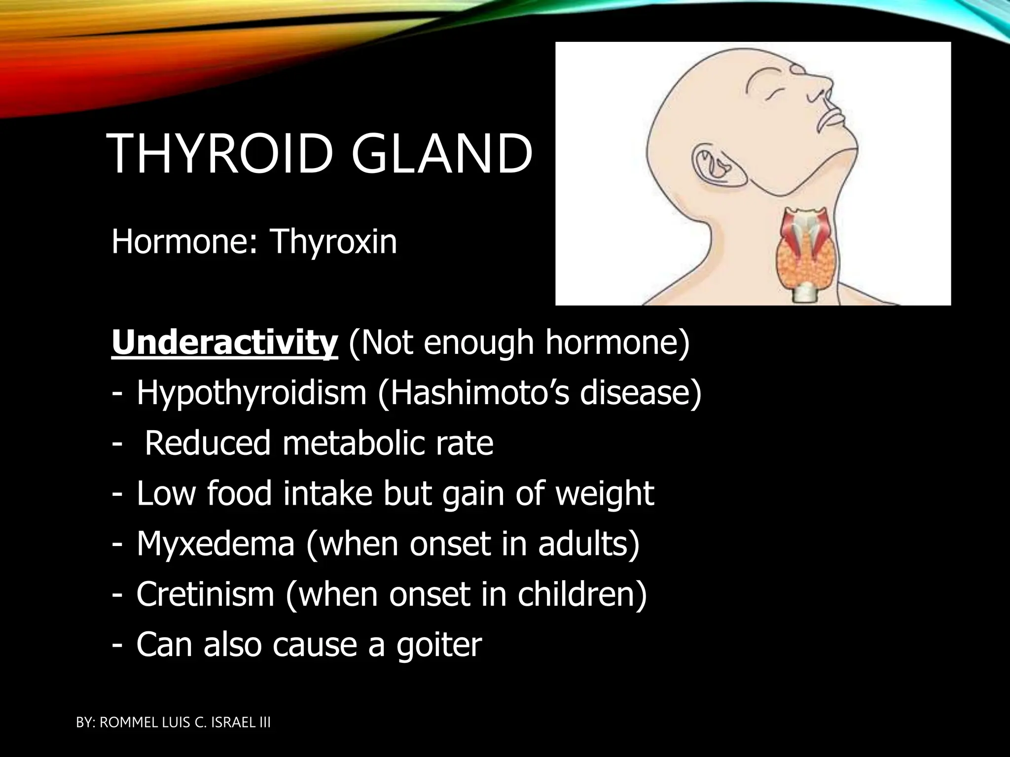 THYROID GLAND
Hormone: Thyroxin
Underactivity (Not enough hormone)
- Hypothyroidism (Hashimoto’s disease)
- Reduced metabolic rate
- Low food intake but gain of weight
- Myxedema (when onset in adults)
- Cretinism (when onset in children)
- Can also cause a goiter
BY: ROMMEL LUIS C. ISRAEL III
6
 
