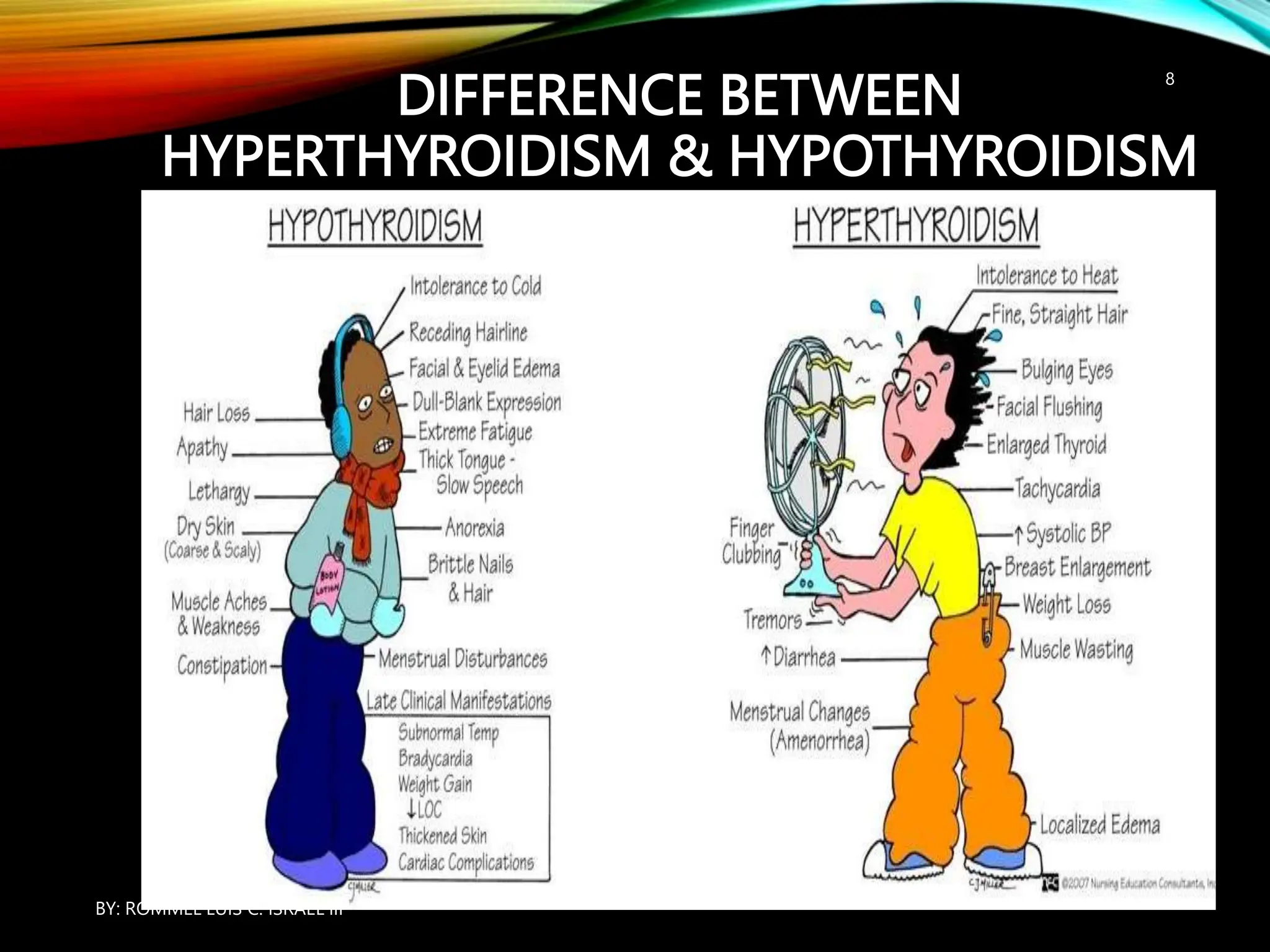 DIFFERENCE BETWEEN
HYPERTHYROIDISM & HYPOTHYROIDISM
BY: ROMMEL LUIS C. ISRAEL III
8
 