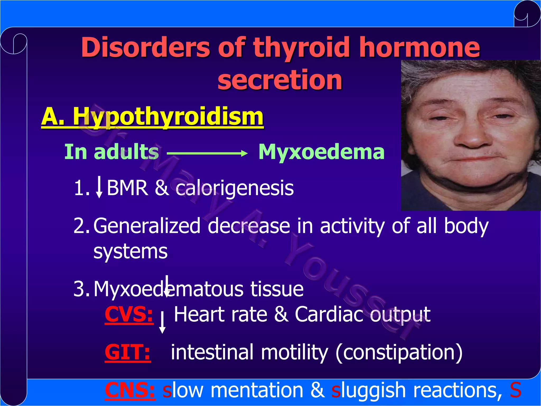 Disorders of thyroid hormone
secretion
A. Hypothyroidism
In adults

Myxoedema

1. BMR & calorigenesis
2. Generalized decrease in activity of all body
systems
3. Myxoedematous tissue
CVS: Heart rate & Cardiac output

GIT: intestinal motility (constipation)
CNS: slow mentation & sluggish reactions, S

 