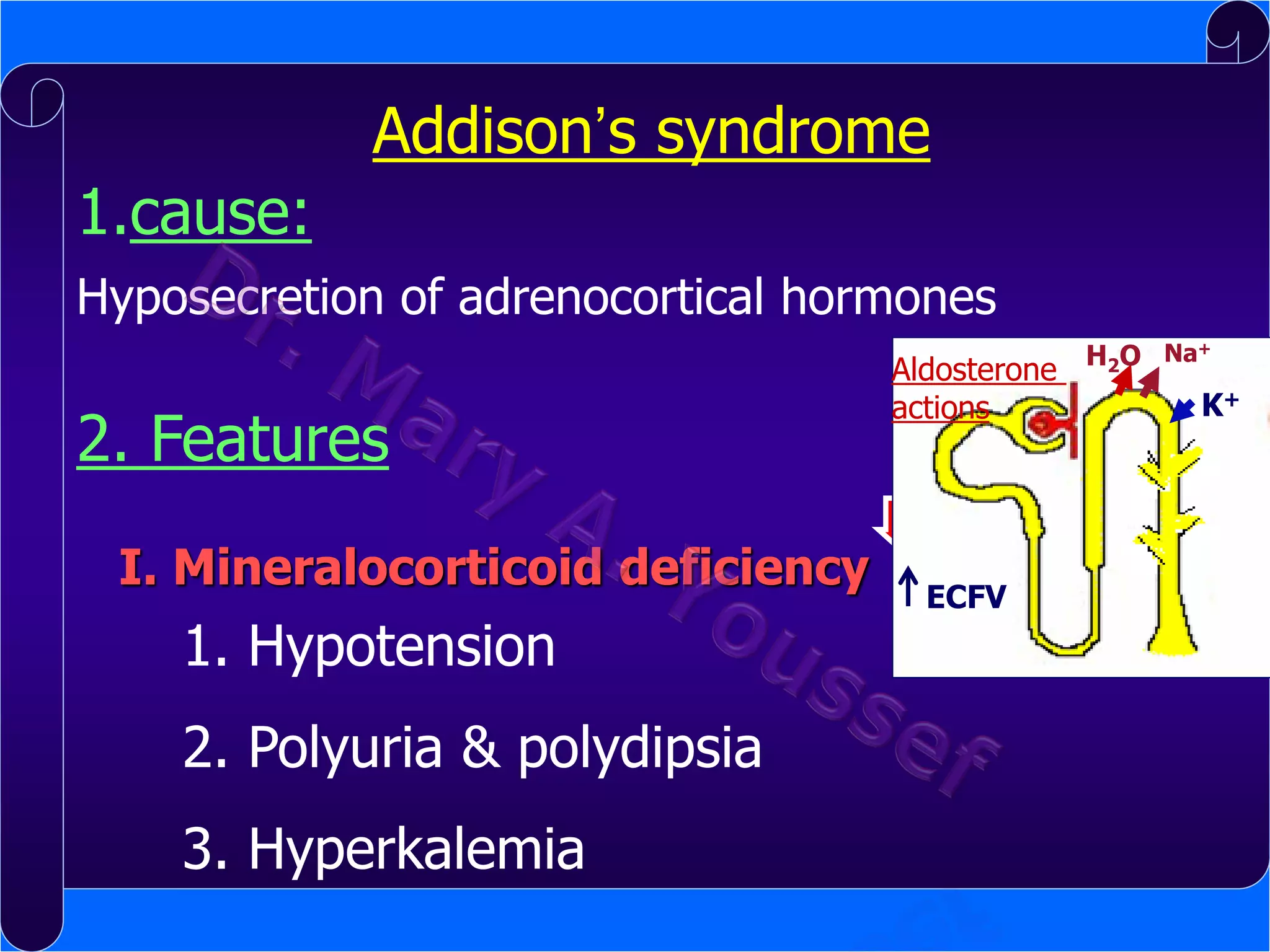 Addison’s syndrome
1.cause:
Hyposecretion of adrenocortical hormones

2. Features
I. Mineralocorticoid deficiency

1. Hypotension
2. Polyuria & polydipsia
3. Hyperkalemia

Aldosterone H2O
actions

Na+

B. K
Actions
Mineraloco
:
rticoids
ECFV

+

 