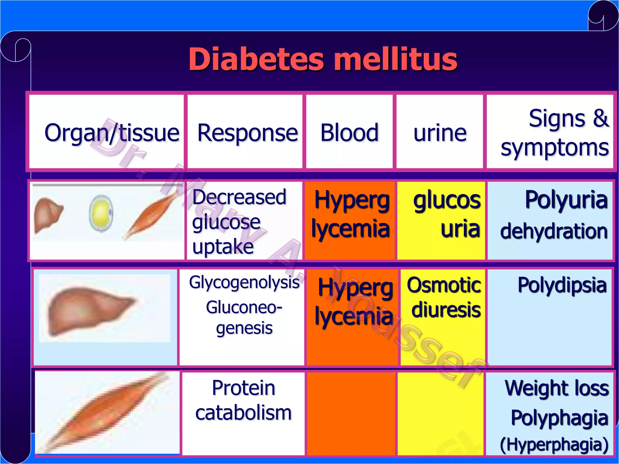 Diabetes mellitus
Organ/tissue Response Blood

urine

Signs &
symptoms

Decreased
glucose
uptake

Hyperg glucos
Polyuria
lycemia
uria dehydration

Glycogenolysis
Gluconeogenesis

Hyperg Osmotic
lycemia diuresis

Protein
catabolism

Polydipsia

Weight loss
Polyphagia
(Hyperphagia)

 