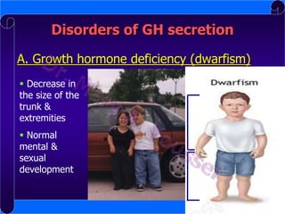 Disorders of GH secretion
A. Growth hormone deficiency (dwarfism)
 Decrease in
the size of the
trunk &
extremities
 Normal
mental &
sexual
development

 