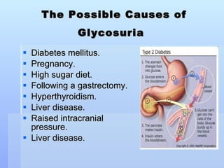 The Possible Causes of Glycosuria   Diabetes mellitus.  Pregnancy. High sugar diet.  Following a gastrectomy. Hyperthyroidism. Liver disease. Raised intracranial pressure.  Liver disease.  