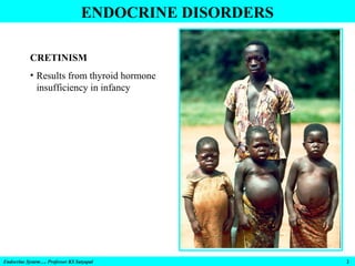 ENDOCRINE DISORDERS
CRETINISM
• Results from thyroid hormone
insufficiency in infancy

Endocrine System…. Professor KS Sat...