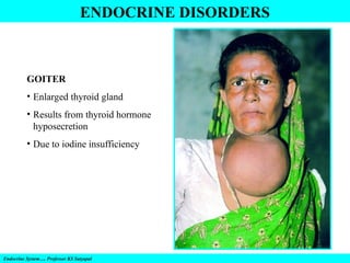 Endocrine System…. Professor KS Satyapal
ENDOCRINE DISORDERS
GOITER
• Enlarged thyroid gland
• Results from thyroid hormone
hyposecretion
• Due to iodine insufficiency
 