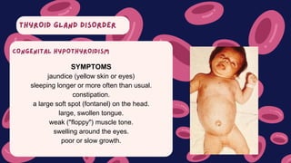 THYROID GLAND DISORDER
SYMPTOMS
jaundice (yellow skin or eyes)
sleeping longer or more often than usual.
constipation.
a large soft spot (fontanel) on the head.
large, swollen tongue.
weak ("floppy") muscle tone.
swelling around the eyes.
poor or slow growth.
CONGENITAL HYPOTHYROIDISM
 