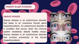 THYROID GLAND DISORDER
Graves disease is an autoimmune disorder
that leads to an overactive thyroid gland
(hyperthyroidism). An autoimmune disorder is
a condition that occurs when the immune
system mistakenly attacks healthy tissue.
Graves disease is an autoimmune disorder
that involves overactivity of the thyroid
(hyperthyroidism).
GRAVES DISEASE
 