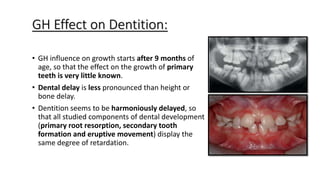 ENDOCRINE SYSTEM ORTHODONTICS.pptx