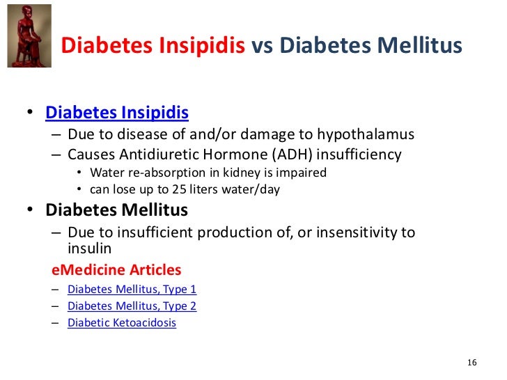 Diabetes Insipidus
