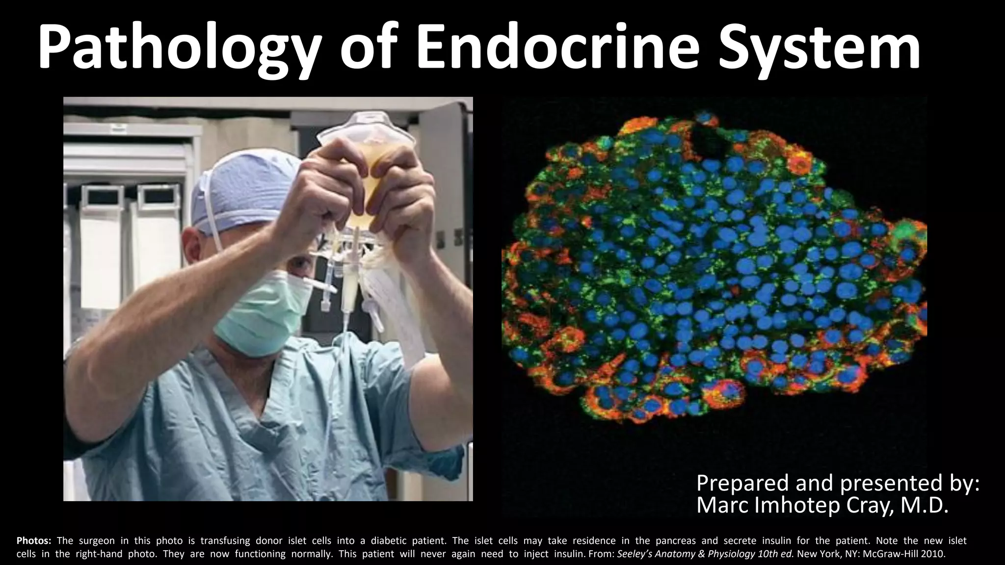 Endocrine System Pathology_ Ppt Lecture Series (5 in 1) | PDF