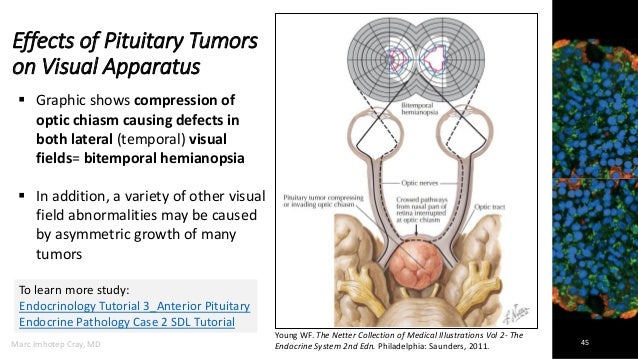 Endocrine System Pathology_ Ppt Lecture Series (5 in 1)