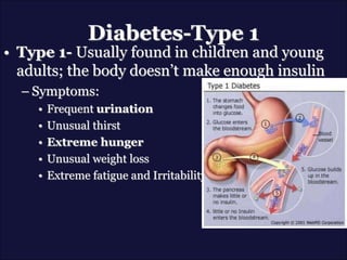 Diabetes-Type 1
• Type 1- Usually found in children and young
adults; the body doesn’t make enough insulin
– Symptoms:
• Frequent urination
• Unusual thirst
• Extreme hunger
• Unusual weight loss
• Extreme fatigue and Irritability
 