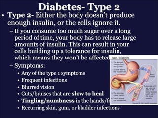Diabetes- Type 2
• Type 2- Either the body doesn’t produce
enough insulin, or the cells ignore it.
– If you consume too much sugar over a long
period of time, your body has to release large
amounts of insulin. This can result in your
cells building up a tolerance for insulin,
which means they won’t be affected by it.
– Symptoms:
• Any of the type 1 symptoms
• Frequent infections
• Blurred vision
• Cuts/bruises that are slow to heal
• Tingling/numbness in the hands/feet
• Recurring skin, gum, or bladder infections
 