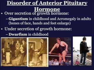 Disorder of Anterior Pituitary
Hormone
• Over secretion of growth hormone:
– Gigantism in childhood and Acromegaly in adults
(bones of face, hands and feet enlarge)
• Under secretion of growth hormone:
– Dwarfism in childhood
 